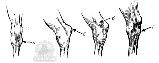 horse79 В плечевом поясе лошади нельзя обнаружить что