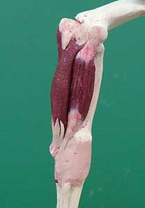 Flexor carpi ulnaris 